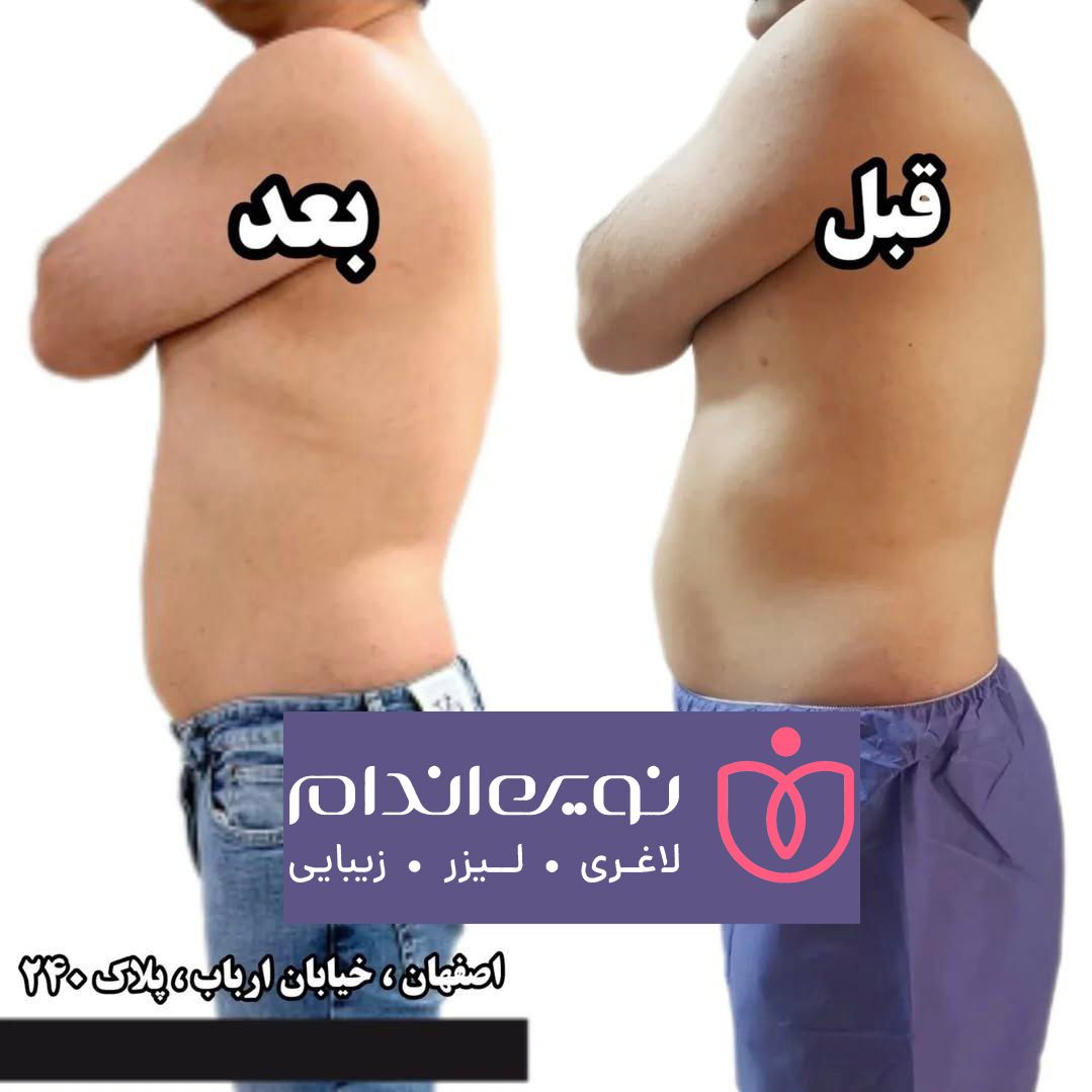 مجموعه زیبایی و لاغری نوین